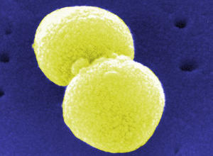 Streptococcus pneumoniae