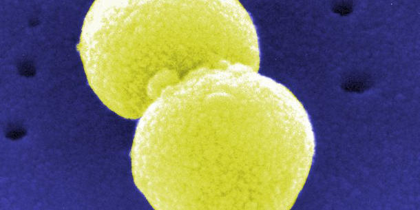 Streptococcus pneumoniae