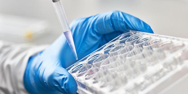 Pipettieren Pipettieren