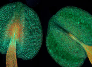 Arabidopsis Antheren