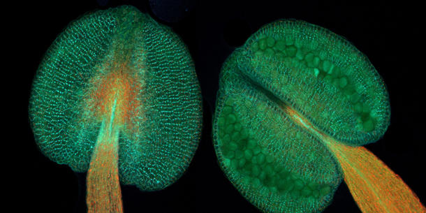 Arabidopsis Antheren