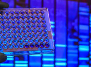 PCR, DNA, Test