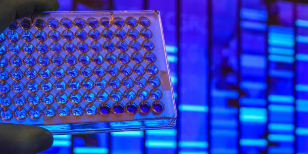 PCR, DNA, Test PCR, DNA, Test