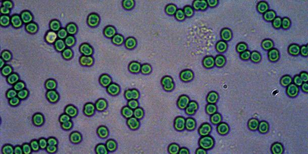 Cyanobakterien Cyanobakterien