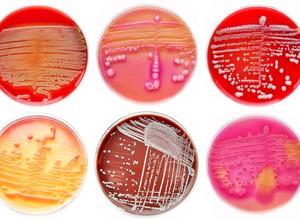 Bakterienkultur