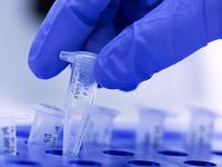 PCR-Nachweis im Labor