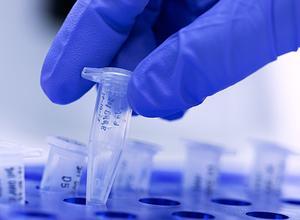 PCR-Nachweis im Labor