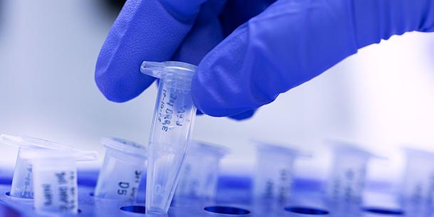 PCR-Nachweis im Labor