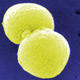 Streptococcus pneumoniae